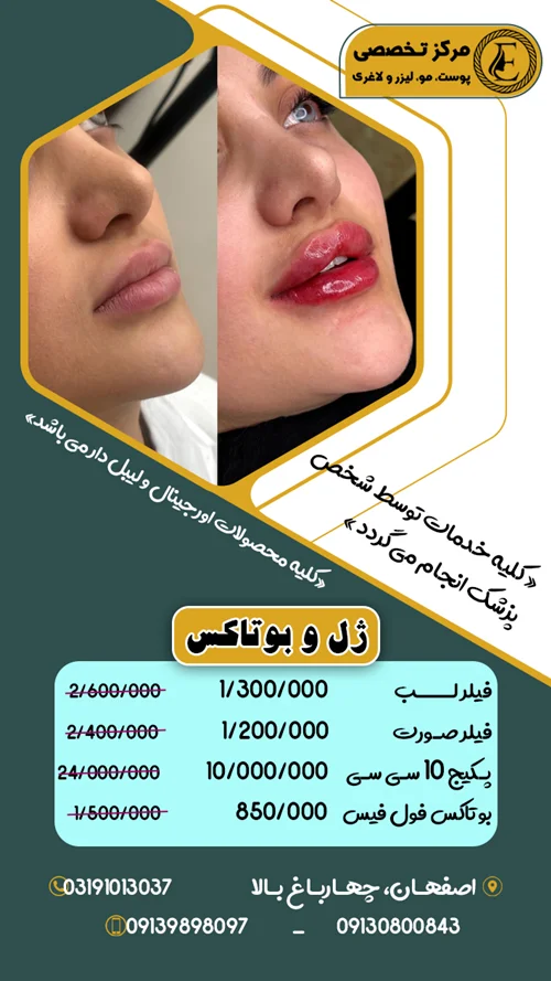 جشنواره ژل